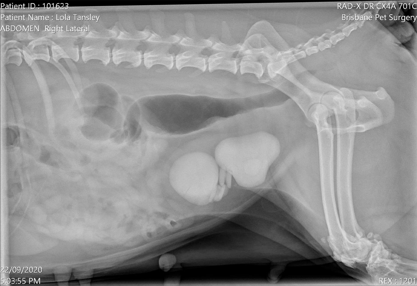 xray of bladder stones