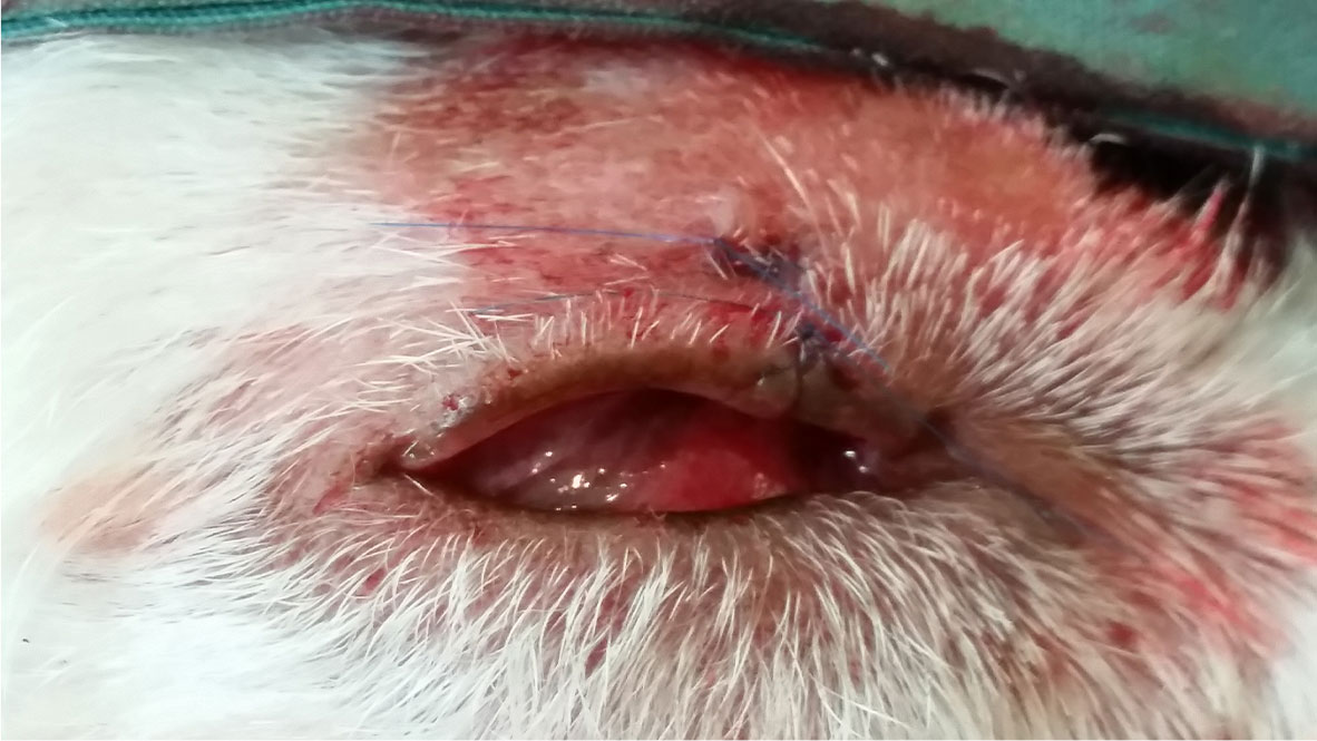 Meibomian Gland Tumours Surgery