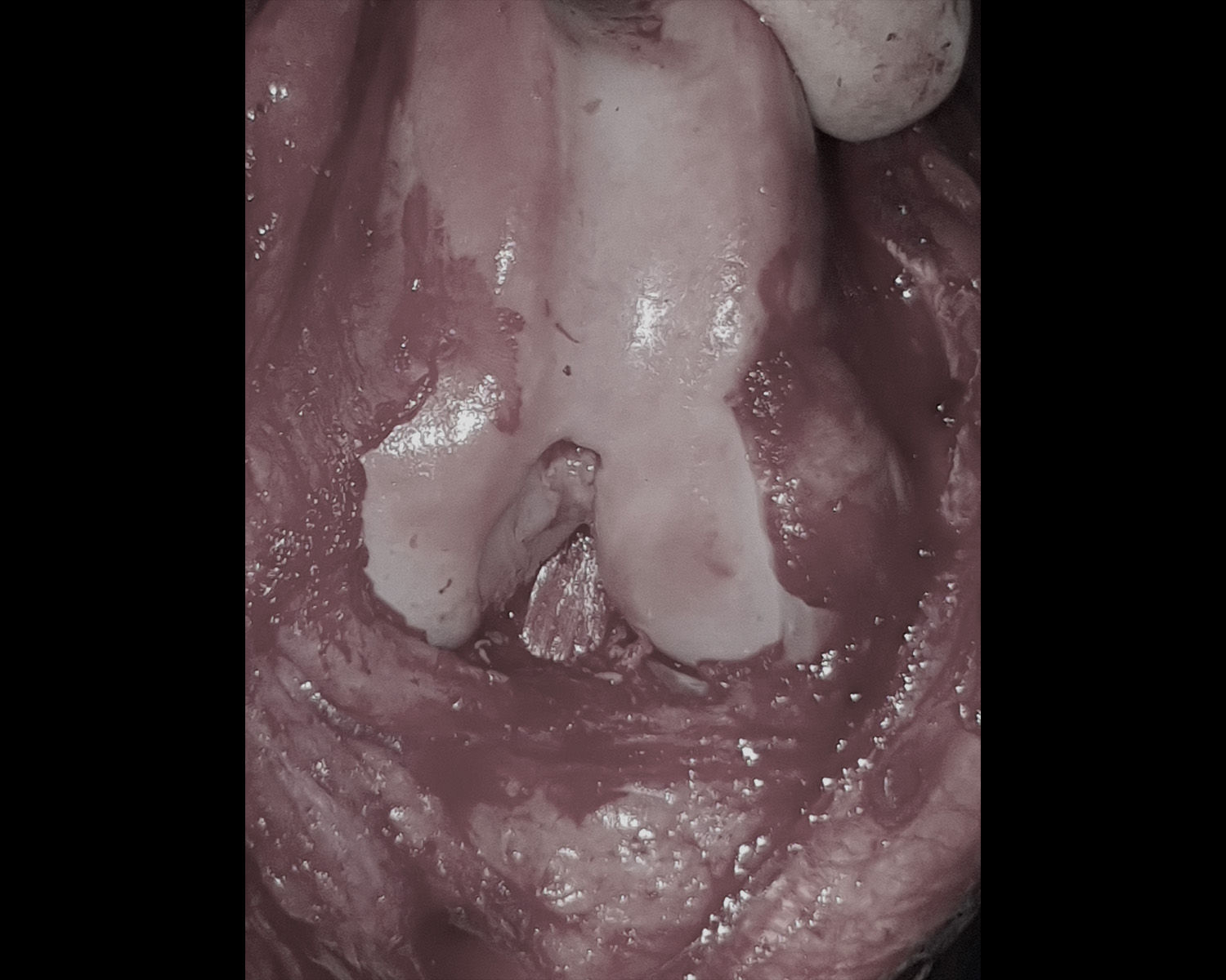 molly-surgery-4