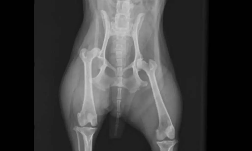 Hip Dislocation