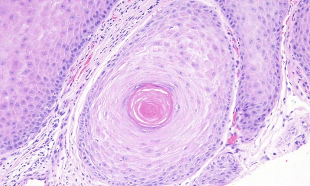 pathology